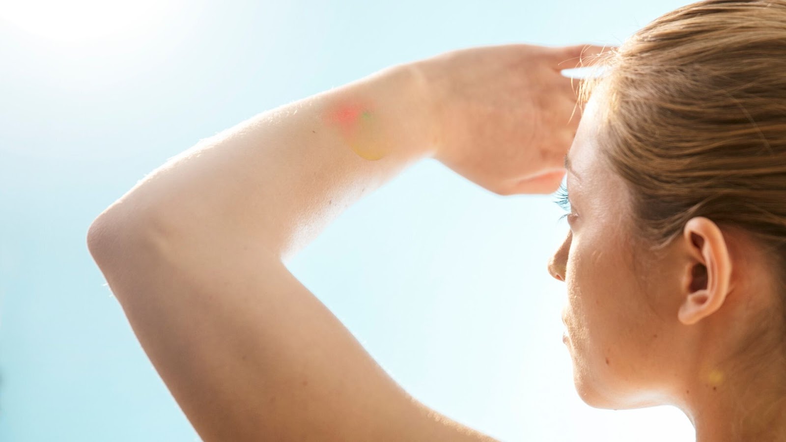 The Best Ways to Prevent Varicose Veins from Getting Worse