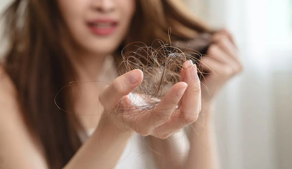 Understanding Hair Loss