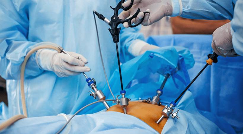 1. Open Surgery