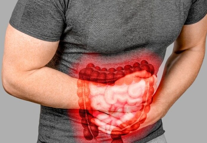 Coping Strategies for Inflammatory Bowel Disease Patients