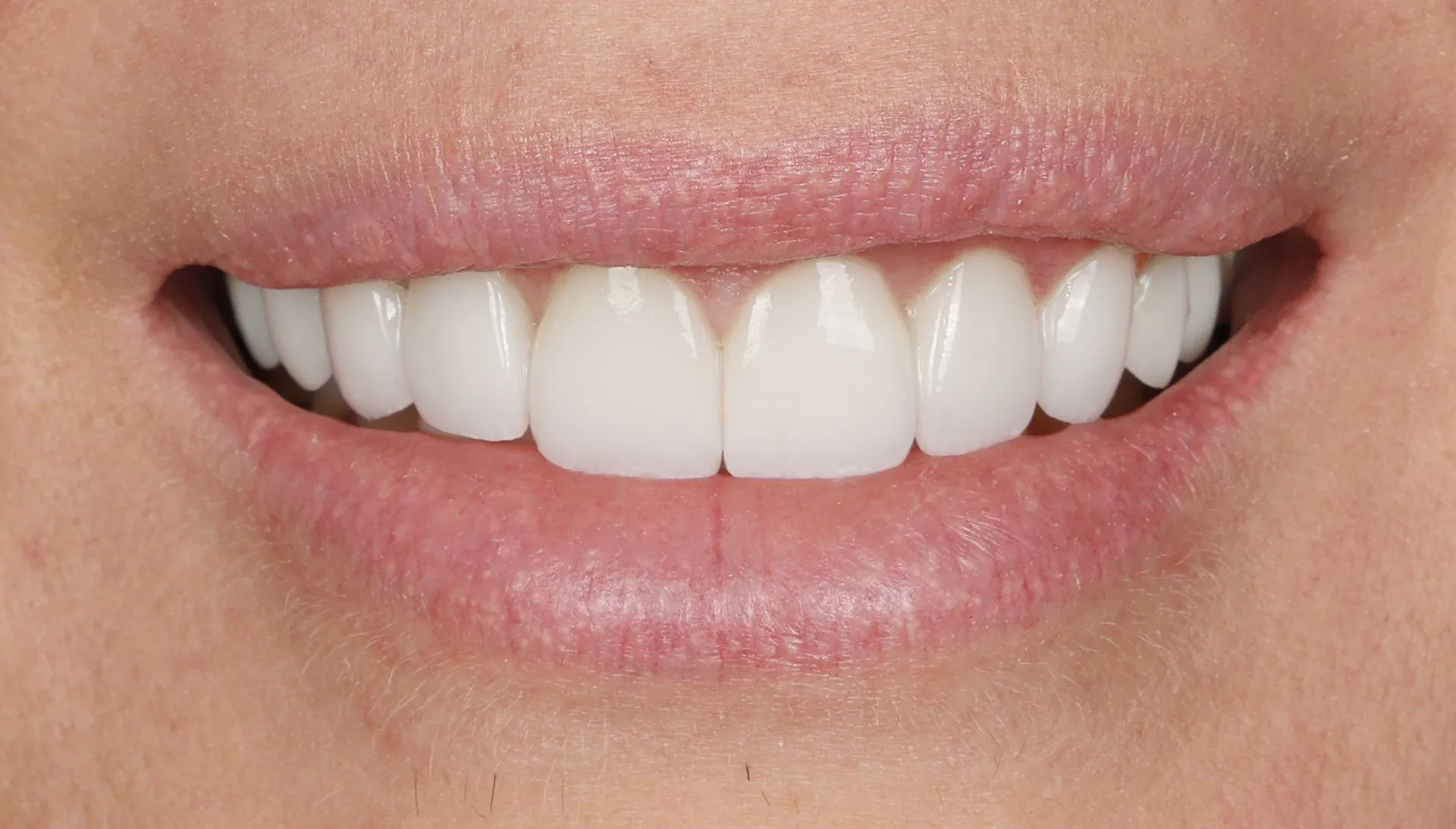 FAQs About Cosmetic Dentistry Procedures