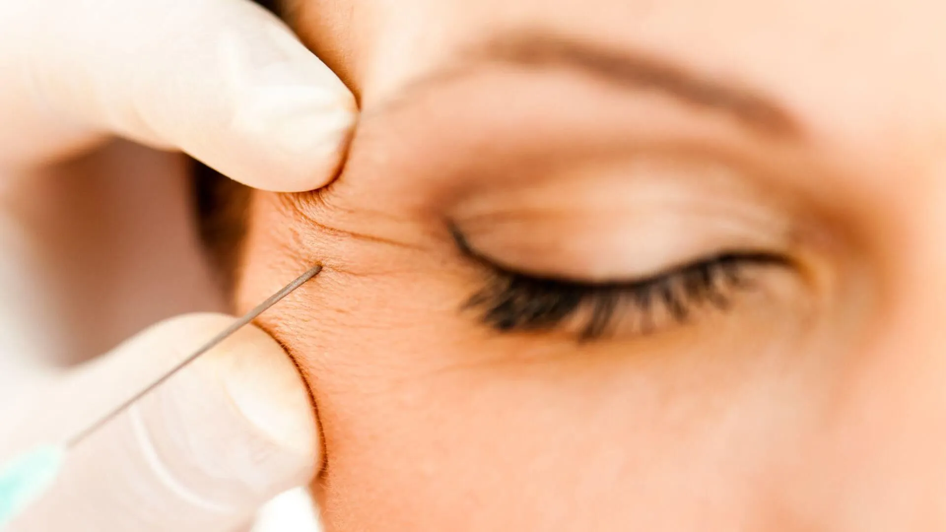 How Botox Can Enhance Your Facial Features Without Surgery
