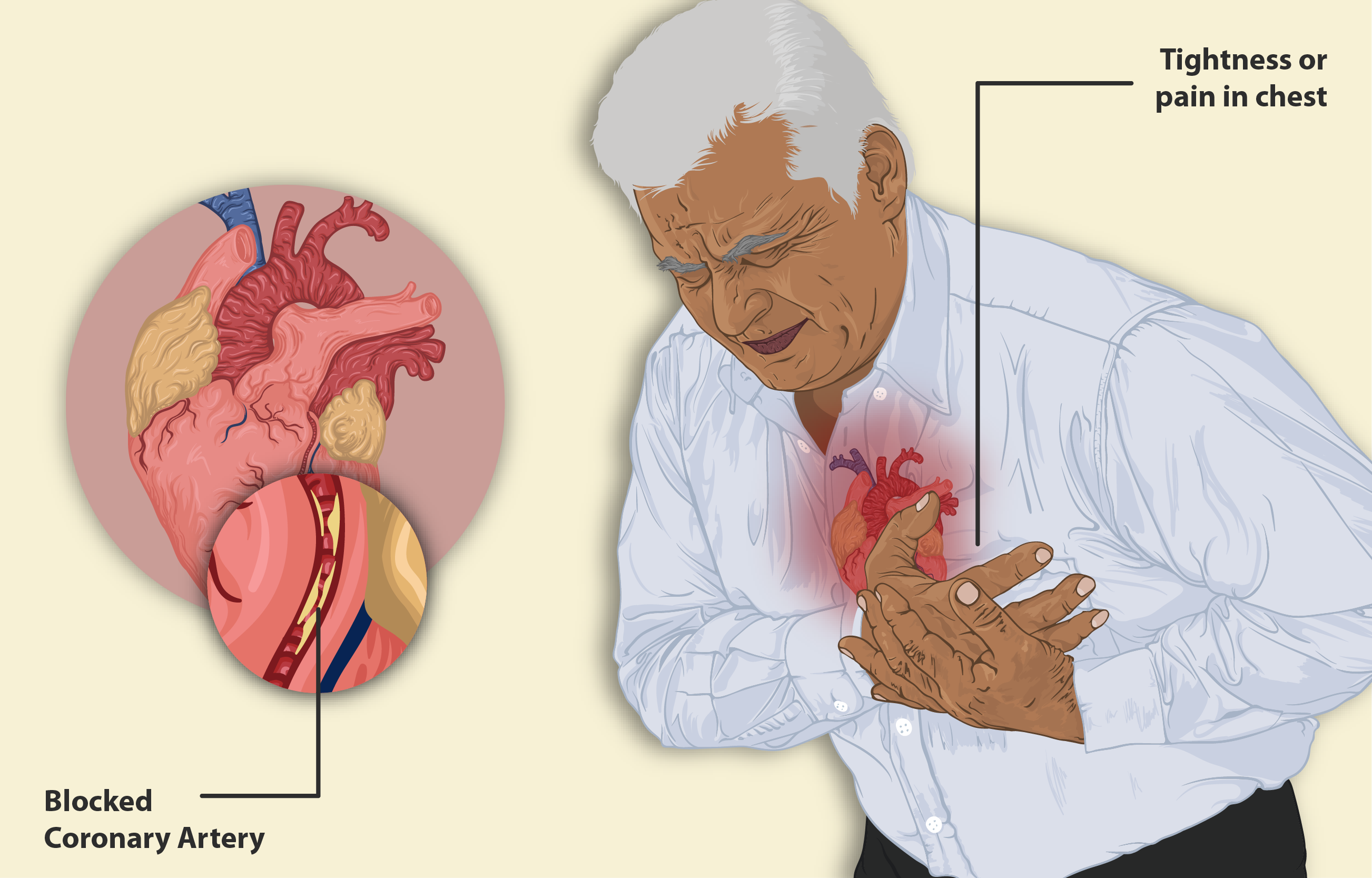 How Chest Pain Can Be a Sign of Serious Heart Conditions