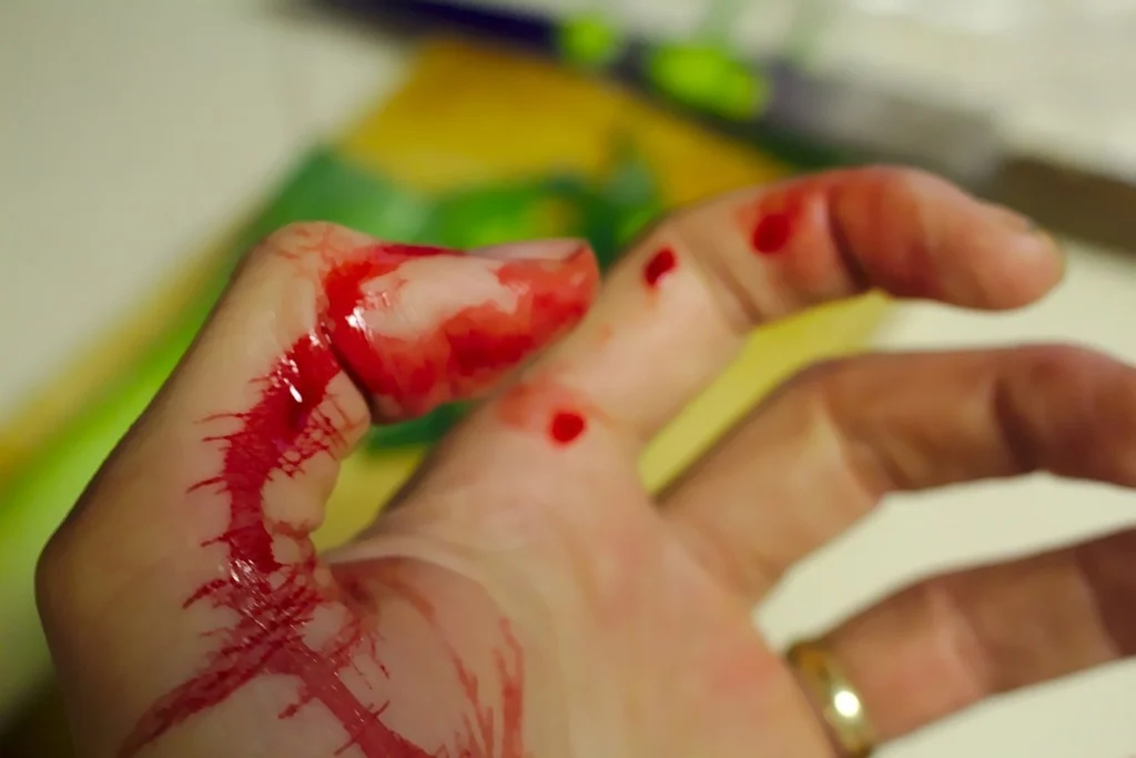 How to Manage Pain While Caring for a Wound