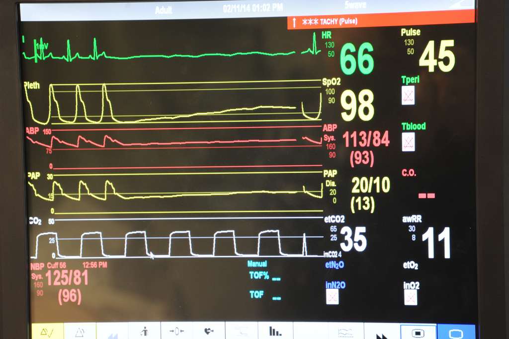 How to Track and Monitor Symptoms of Congestive Heart Failure at Home