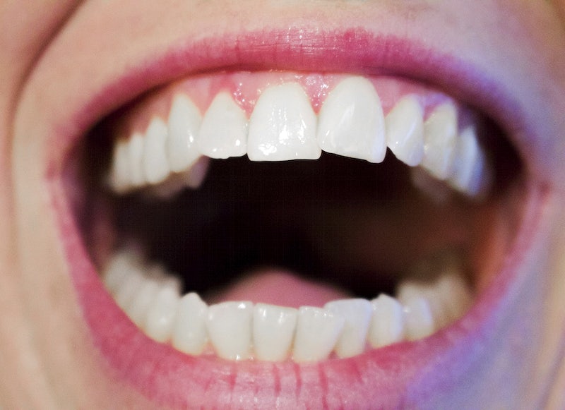 Preventing Staining After Teeth Whitening