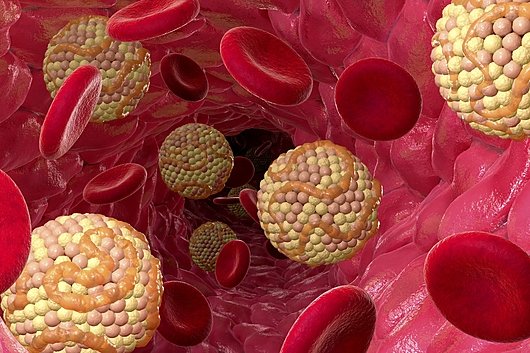 The Connection Between Heart Disease and High Cholesterol