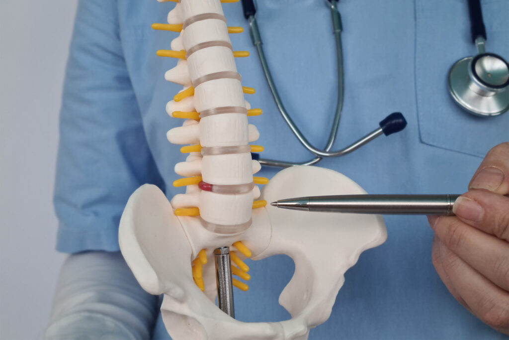 The Importance of Early Diagnosis for Degenerative Disc Disease