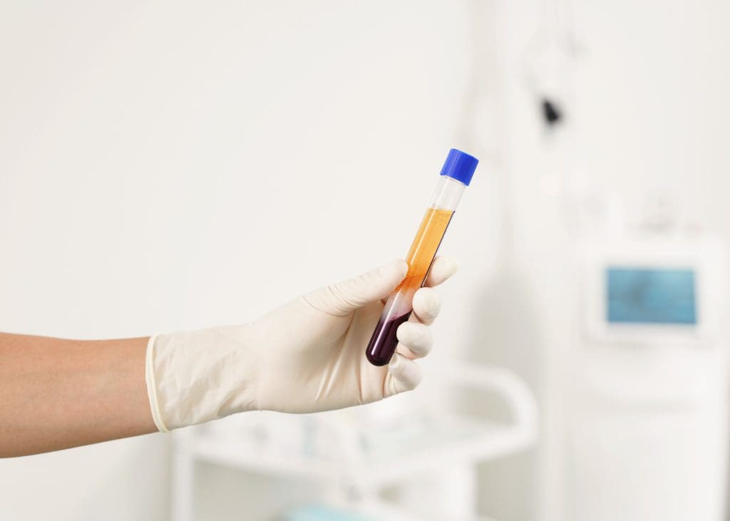 Top Benefits of Stem Cell Therapy for Chronic Conditions