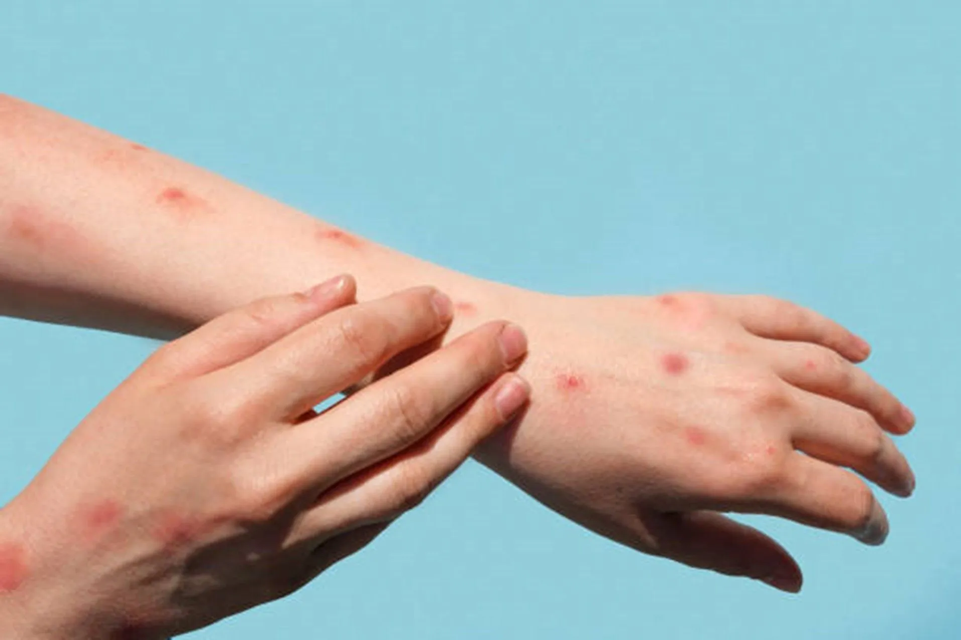 What an Allergy Specialist Can Do for You