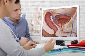 What are the Early Signs of Prostate Cancer?