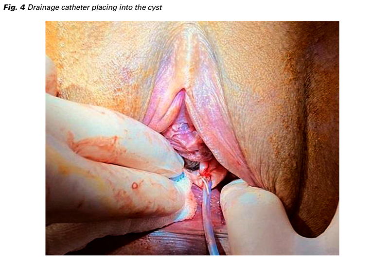 4 Conditions Treated by a Gynecologist
