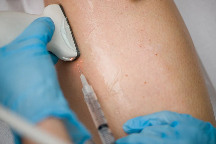 When Should I See A Vein Specialist?
